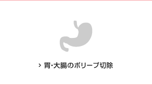 胃・大腸のポリープ切除