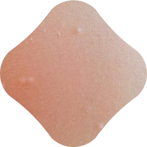 イボ